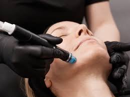 HydraFacial treatment at Dr. Bhinder Clinic